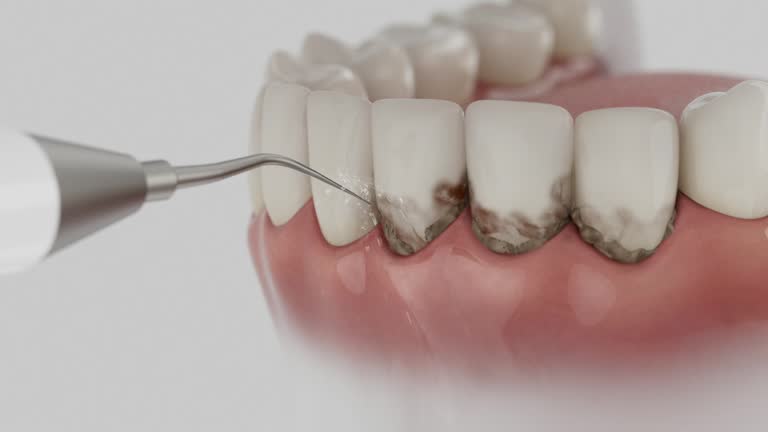 Reliable Dental contractor in Delano, MN by Smile Center Dentistry